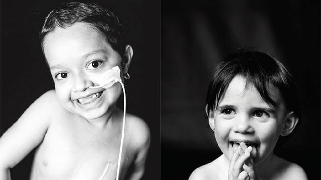 La sonrisa del trasplante infantil