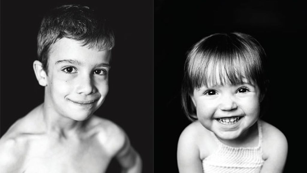 La sonrisa del trasplante infantil