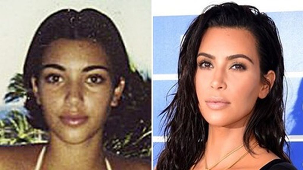 Kim 2
