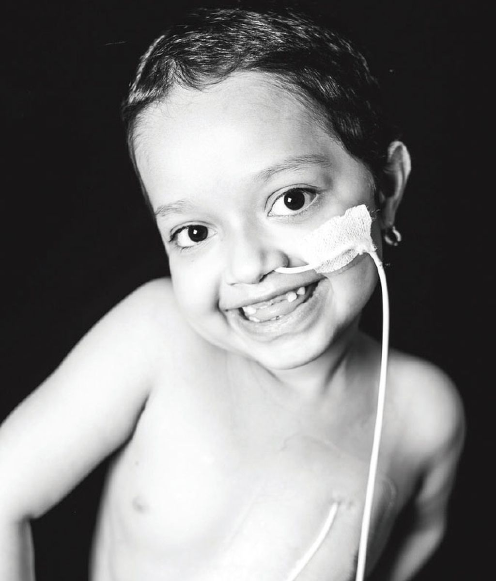 La sonrisa del trasplante infantil