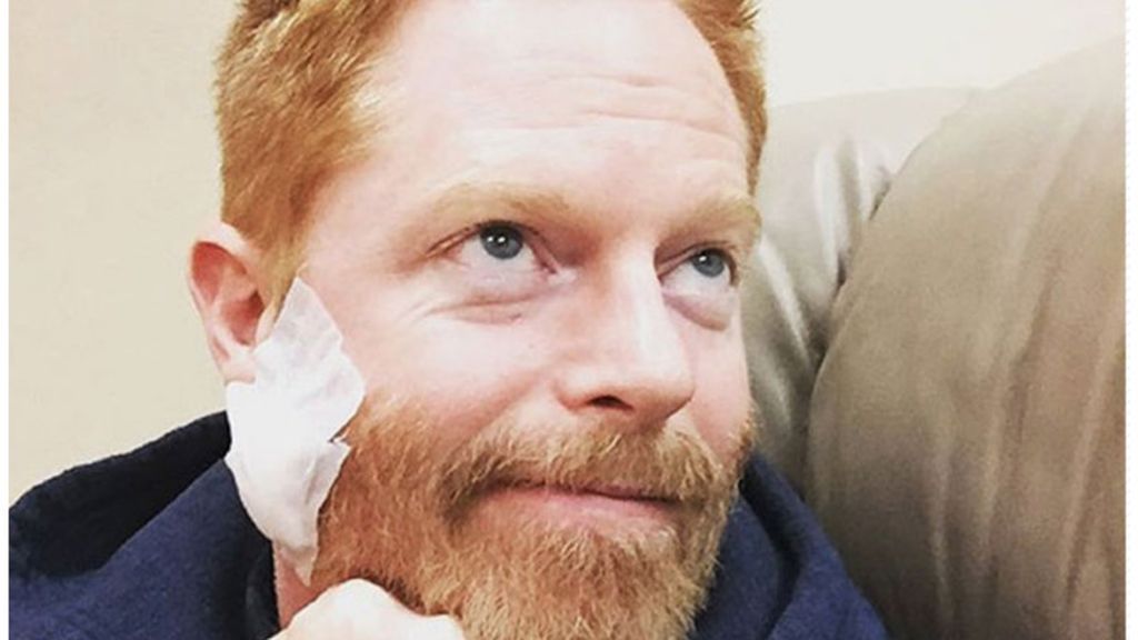 Jesse Tyler Ferguson se libra de un cáncer de piel