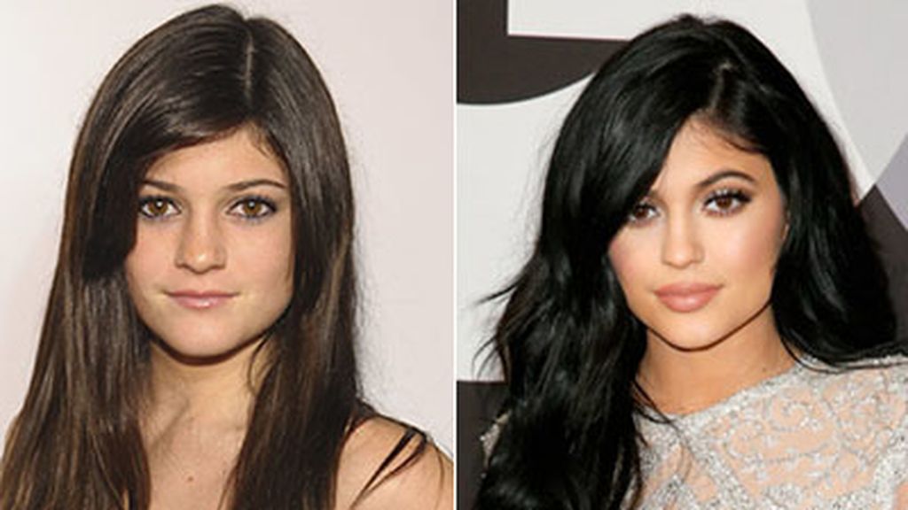 kylie jenner-antes y despues