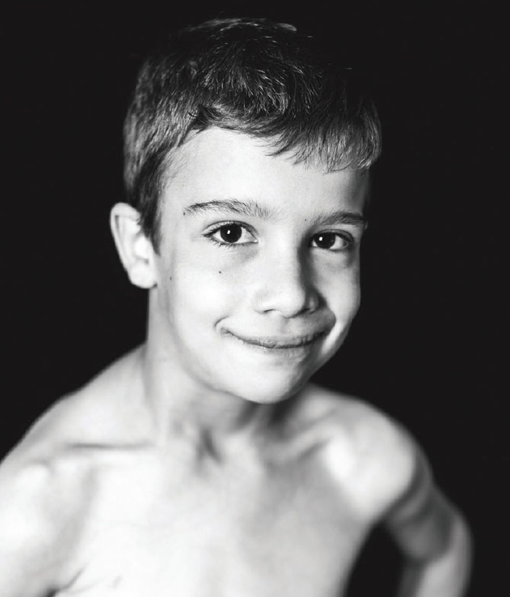 La sonrisa del trasplante infantil