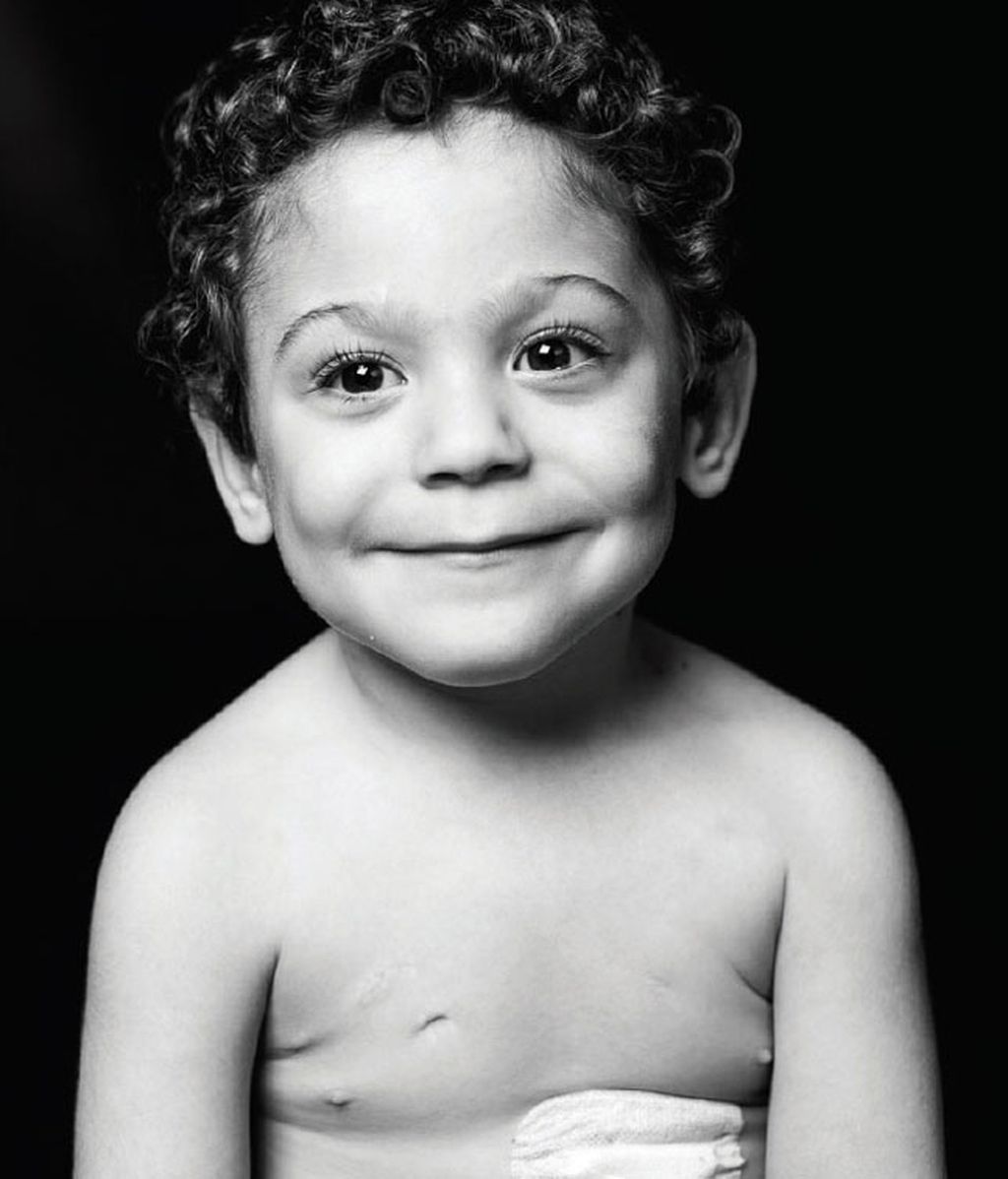 La sonrisa del trasplante infantil