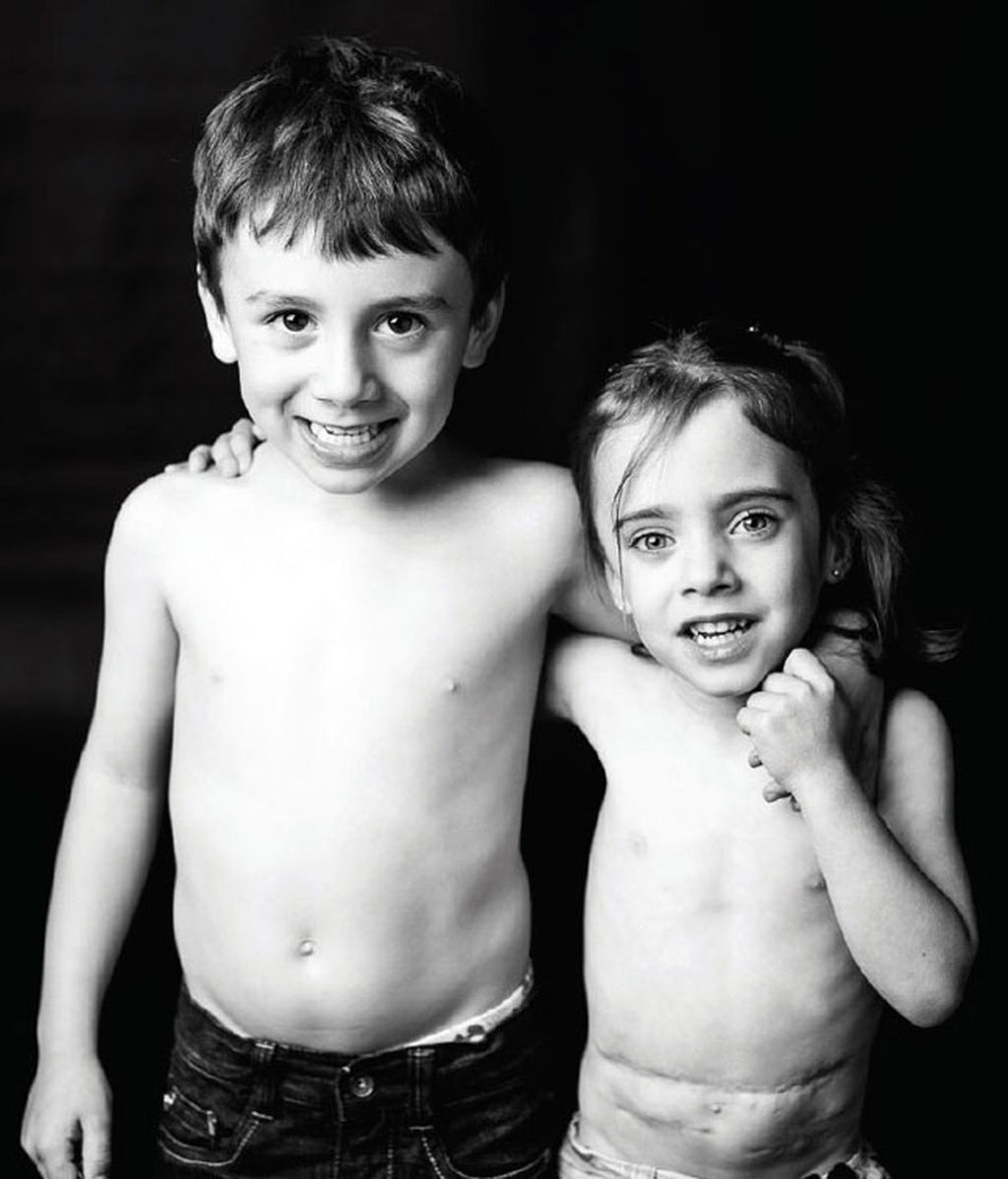 La sonrisa del trasplante infantil