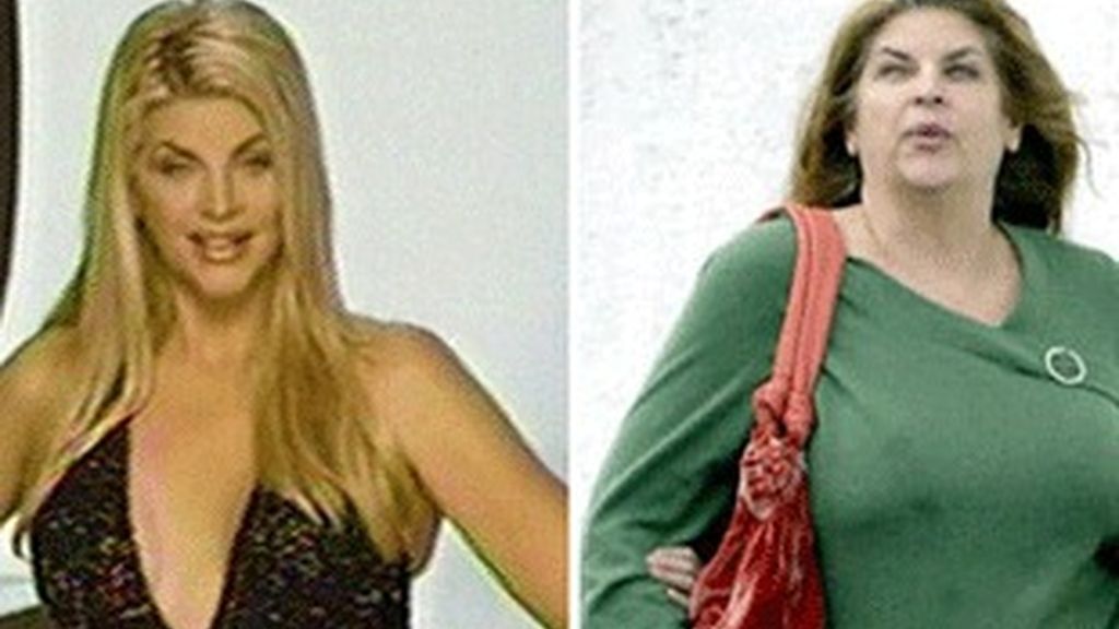 Kirstie Alley, antes y después.