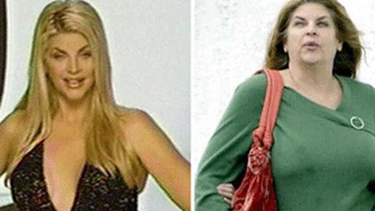 Kirstie Alley, antes y después.
