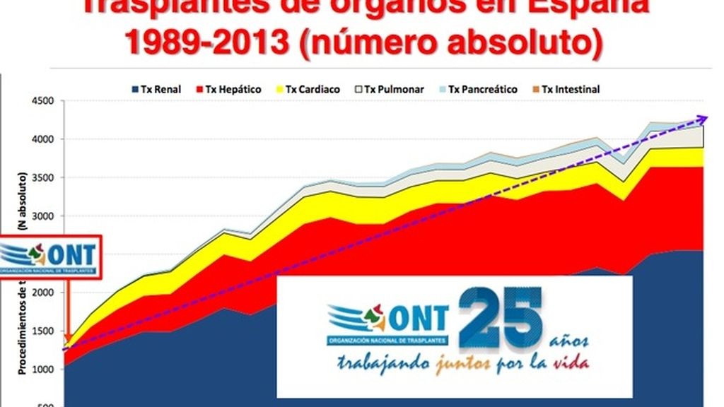 Historia ONT