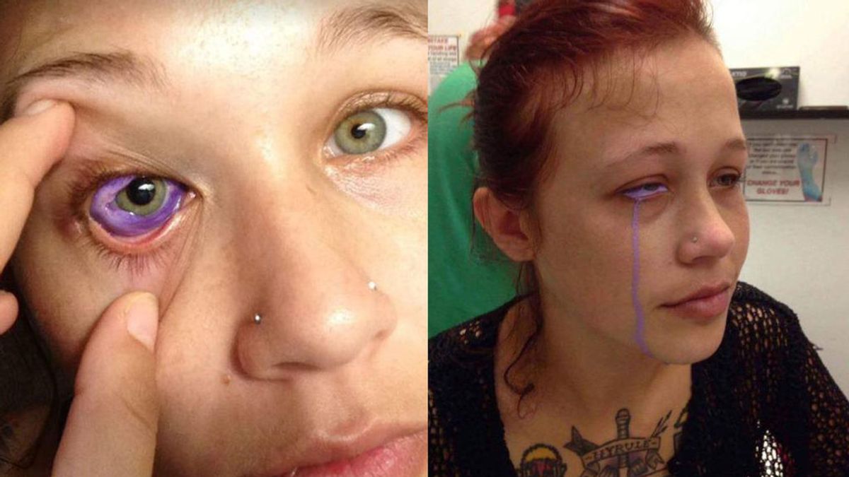 El tatuaje en el ojo de una modelo que le ha provocado pérdida de visión