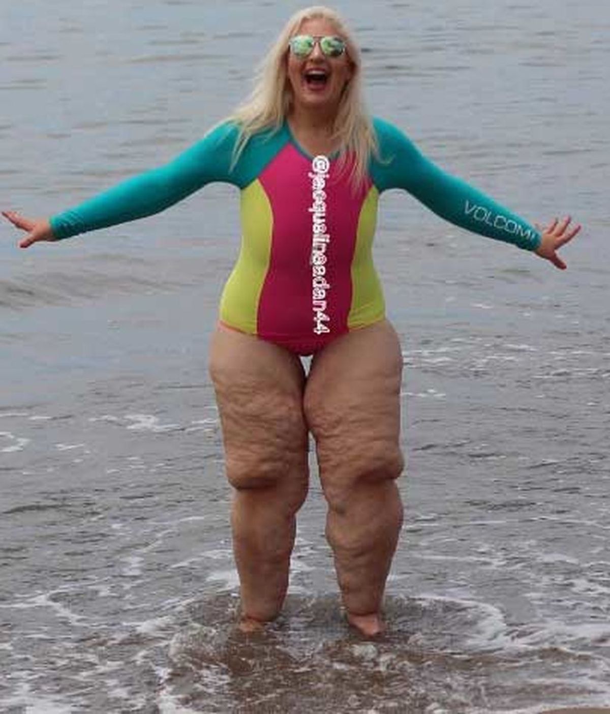 Desata las burlas de la gente cuando se queda en bañador tras perder 158 kilos de peso