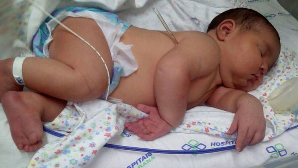 Gabriella, la ‘pequeña’ que sorprende en Brasil por pesar casi seis kilos al nacer