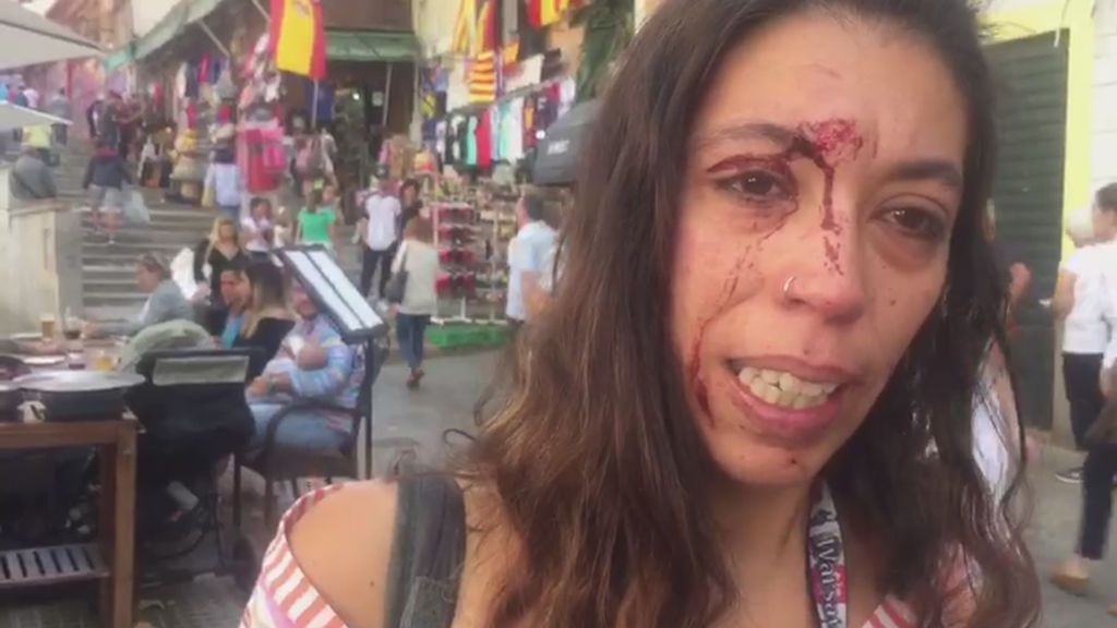 Denuncia una agresión en una manifestación en Palma: "Les llamé fachas y me tiraron una piedra"
