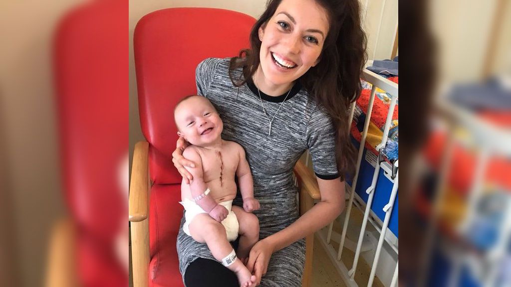 La sonrisa de un bebé horas después de ser operado del corazón