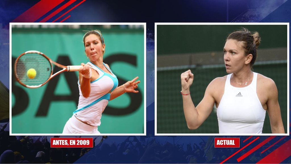 Serena Wiliams no y Simona Halep sí... La tenista que se operó el pecho para poder ser la número uno