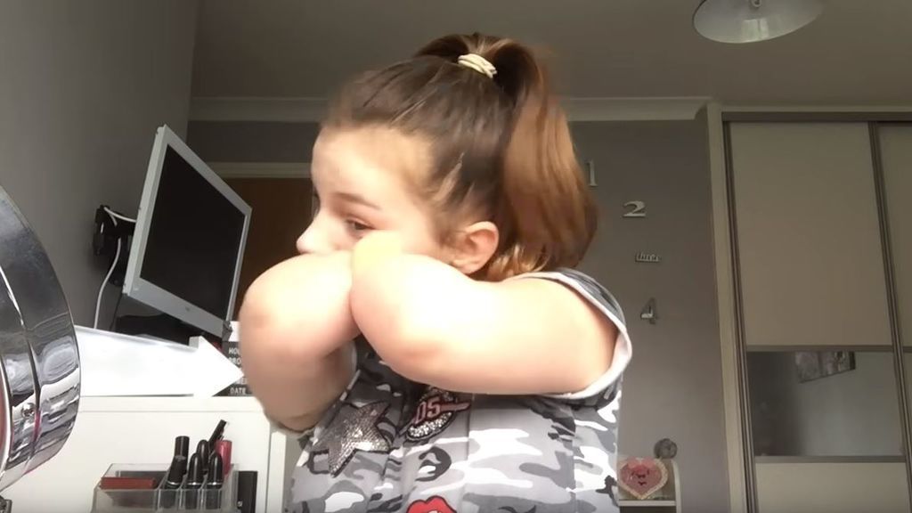 Esta niña perdió sus extremidades por la meningitis y ahora es una estrella en las redes