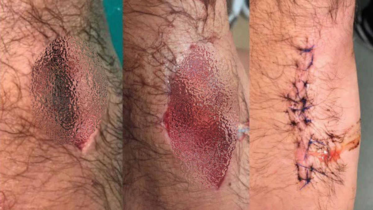 Así es el mordisco de un león: el jugador de rugby Scott Baldwin muestra su herida… ¡sobrecogedor!