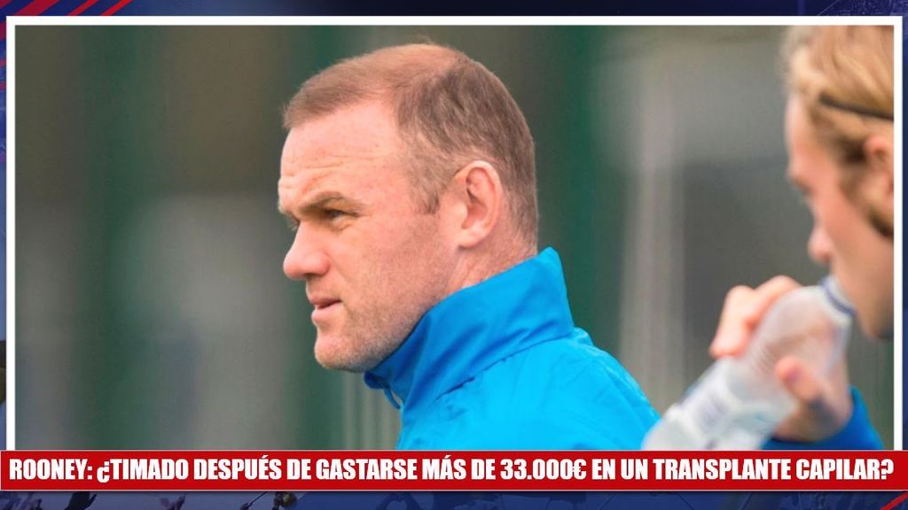 ¡La calvicie le persigue! Rooney vuelve a perder el pelo tras gastarse 33.000€ en transplantes
