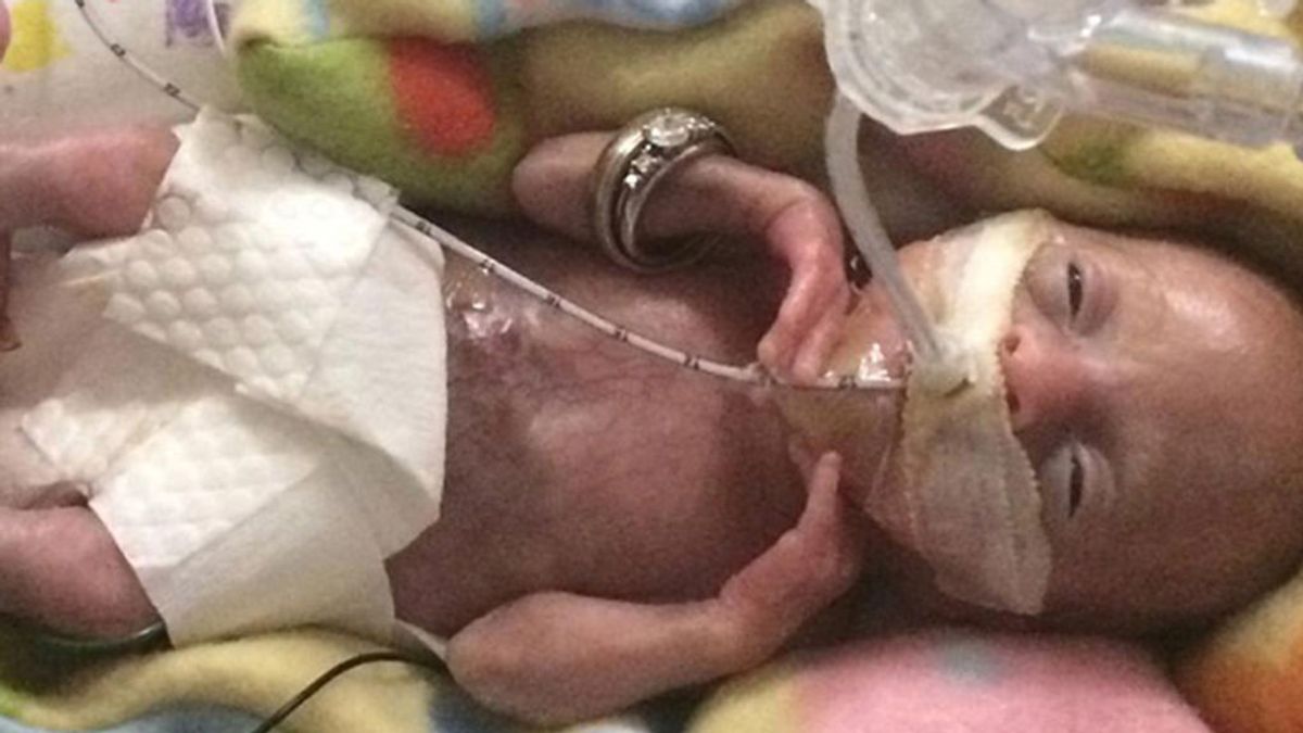 Se da a conocer al bebé más prematuro del mundo, nació con 21 semanas y sobrevivió