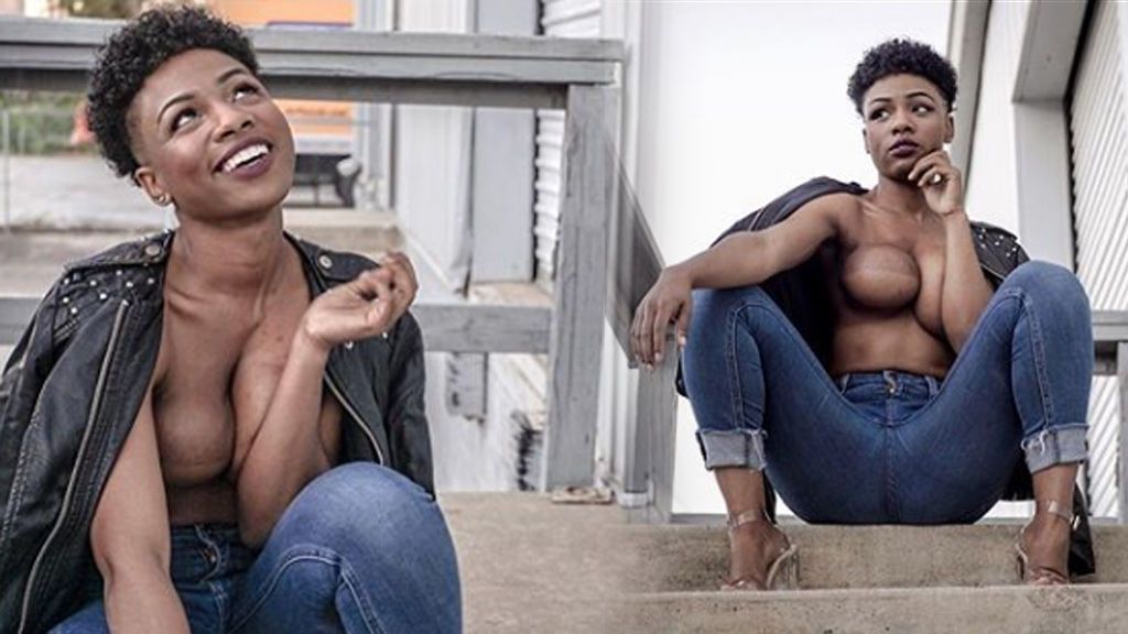 Celebra haber ganado la batalla al cáncer de mama con una sesión de fotos en topless