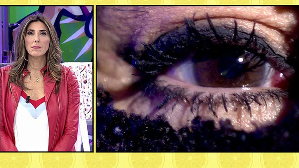 'Sálvame' entrevista al ojo de Leticia Sabater tras su operación: "Me ha despersonalizado"