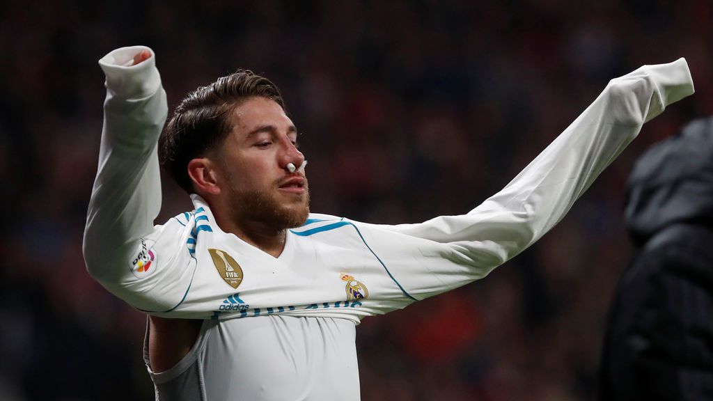 Así ha quedado la nariz de Sergio Ramos tras la patada de Lucas Hernández al intentar despejar un balón