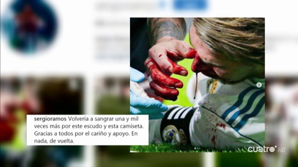 El mensaje de Sergio Ramos tras su fractura del tabique nasal: “Volvería a sangrar una y mil veces por este escudo”