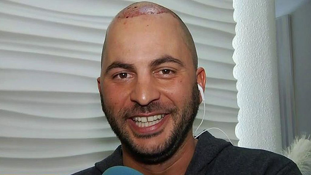 'Sálvame': Antonio Tejado se ha sometido a un injerto capilar