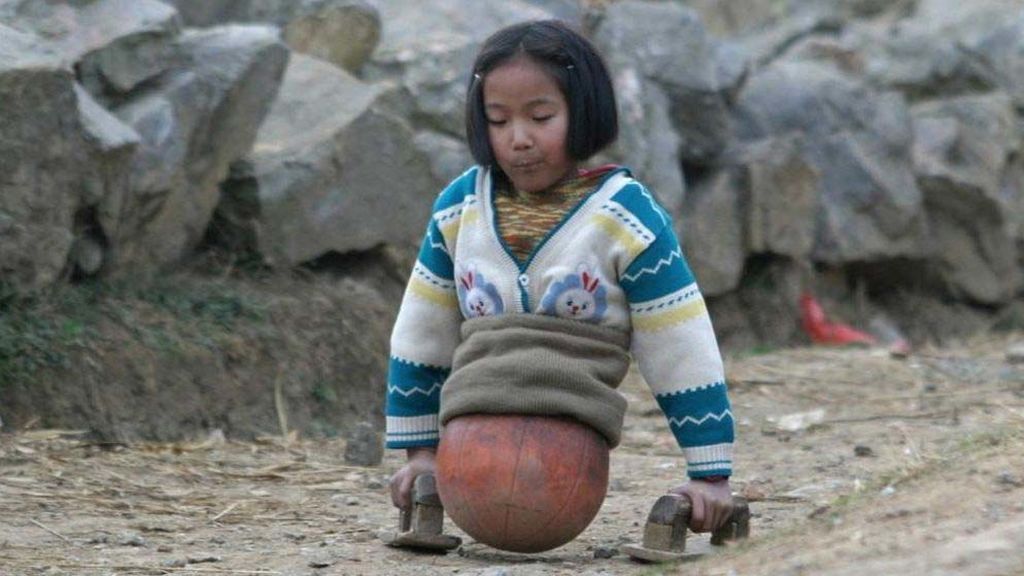 La increíble historia de la niña sin piernas y con una pelota de baloncesto pegada al cuerpo