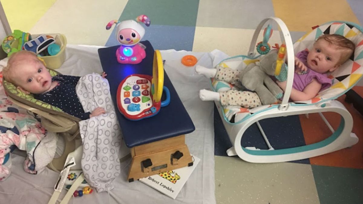 Salen del hospital las gemelas operadas tras nacer unidas por la cabeza