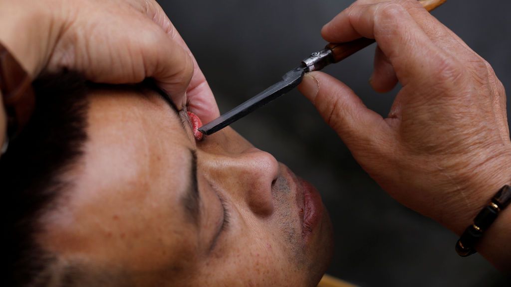 Afeitado de párpados, la exótica técnica china de limpieza de ojos