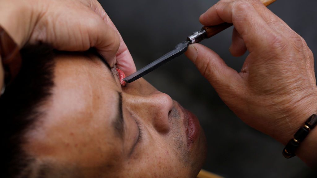 Afeitado de párpados, la exótica técnica china de limpieza de ojos