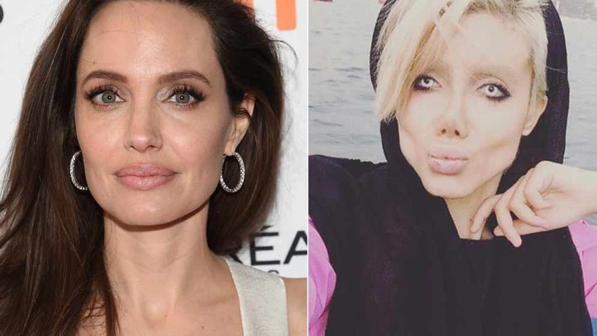 Cincuenta operaciones para ser Angelina Jolie y termina pareciendo la novia cadáver