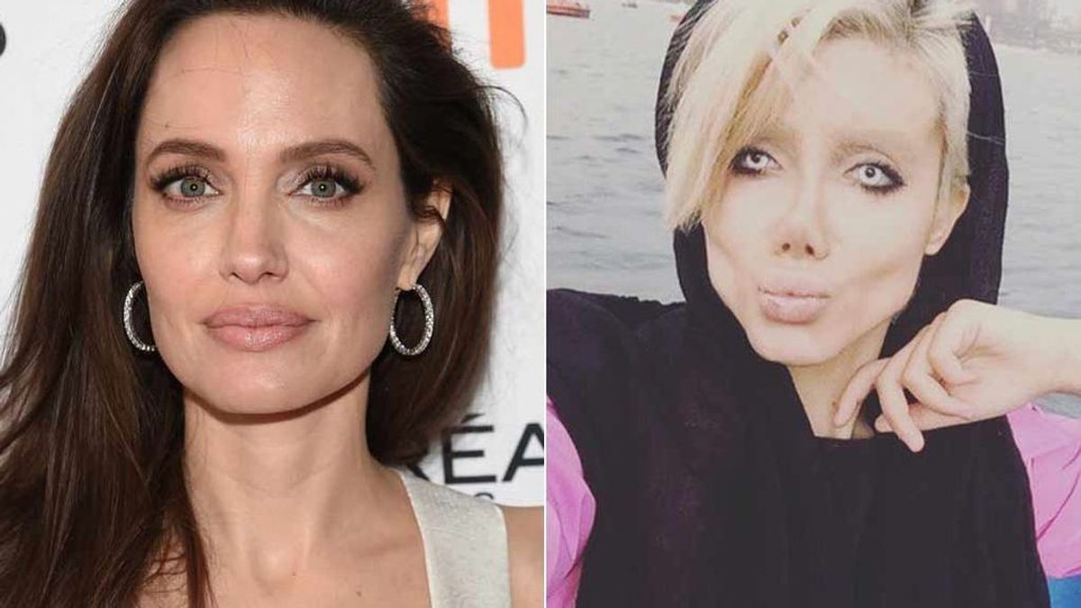 Cincuenta operaciones para ser Angelina Jolie y termina pareciendo la novia cadáver