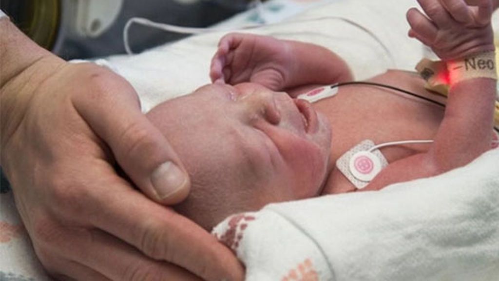 Una madre cumple un sueño imposible: Dar a luz al primer bebé de un útero trasplantado en EE.UU.