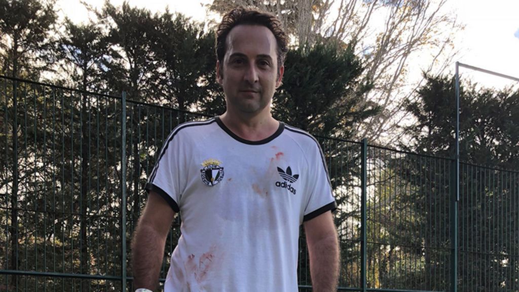 Iker Jiménez sube una foto con la camiseta ensangrentada y ... Iker Jiménez sube una foto con la camiseta ensangrentada y ...