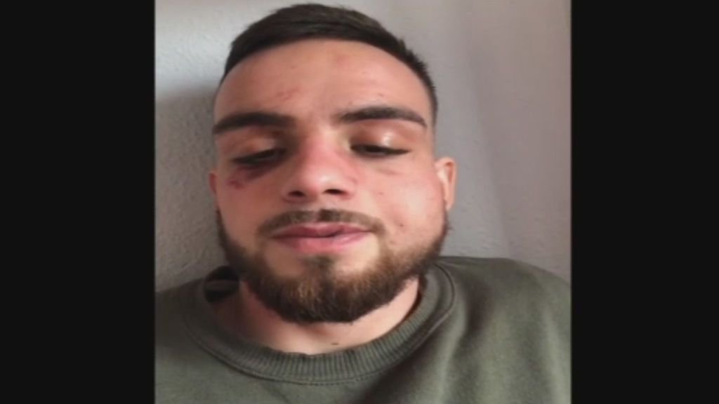 Un joven denuncia en la red una brutal agresión de los porteros de una discoteca de Granada