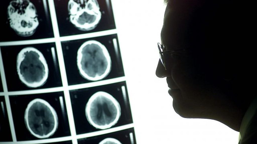Las cinco cosas que puedes hacer para reducir el riesgo de padecer cáncer Las cinco cosas que puedes hacer para reducir el riesgo de padecer cáncer