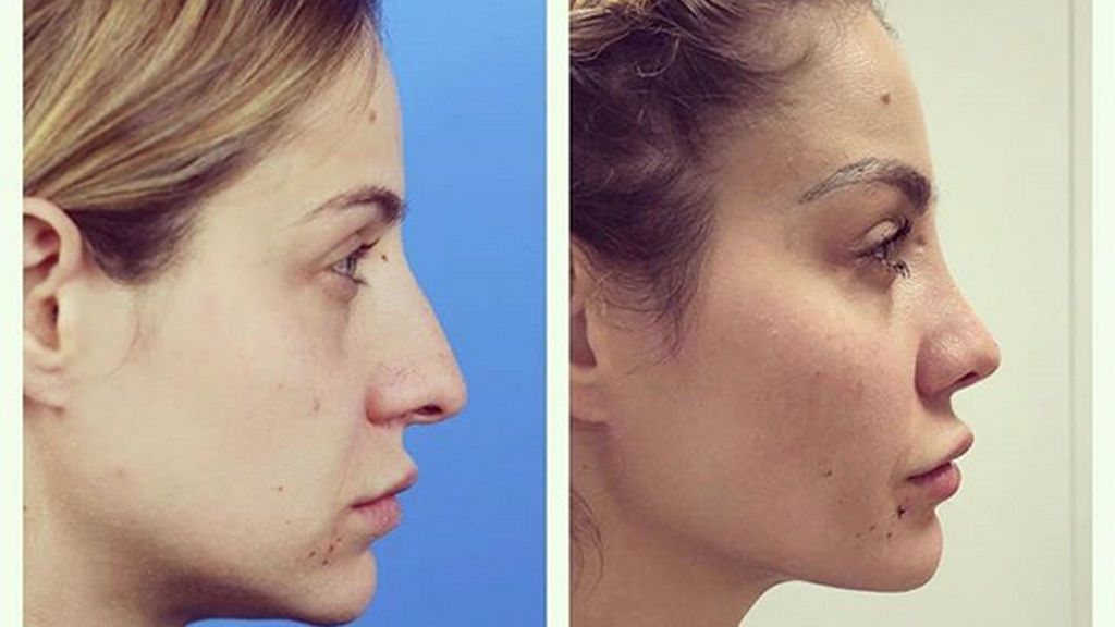 ¡Ni te lo imaginas! El nuevo retoque estético al que se ha sometido Ariadna Cross ¡Ni te lo imaginas! El nuevo retoque estético al que se ha sometido Ariadna Cross