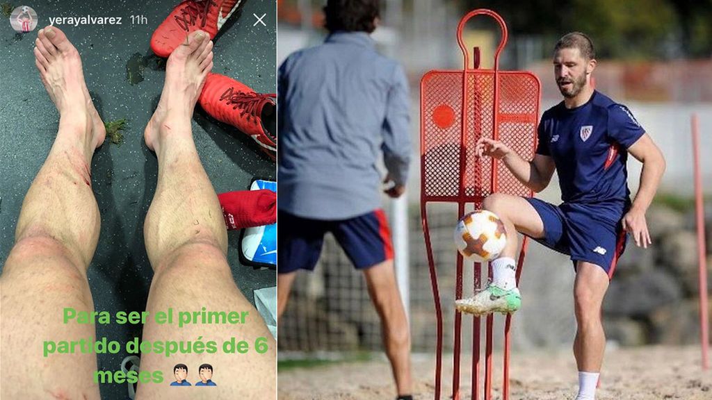 Golpes que no duelen: Yeray disputa su primer partido tras vencer al cáncer y muestra sus heridas en redes 💪 Golpes que no duelen: Yeray disputa su primer partido tras vencer al cáncer y muestra sus heridas en redes 💪