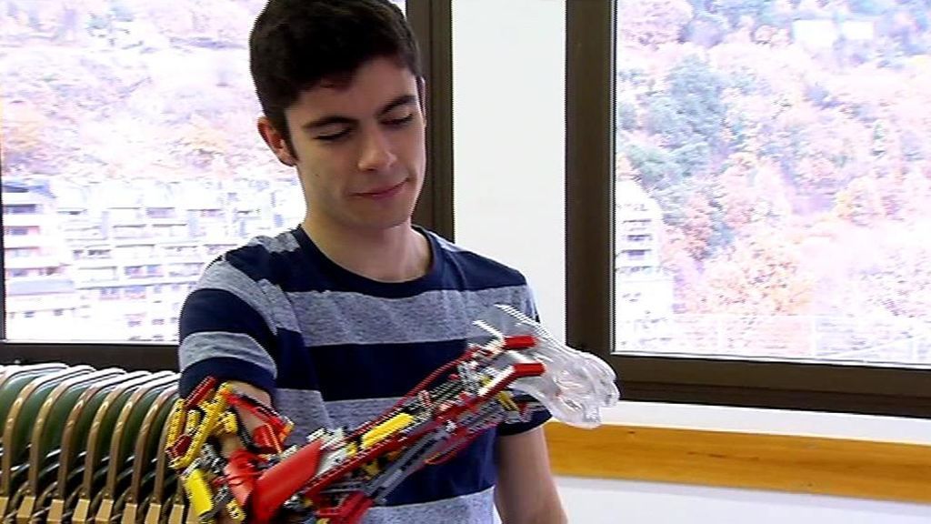 Utiliza piezas 'Lego' para construir la prótesis de su brazo derecho