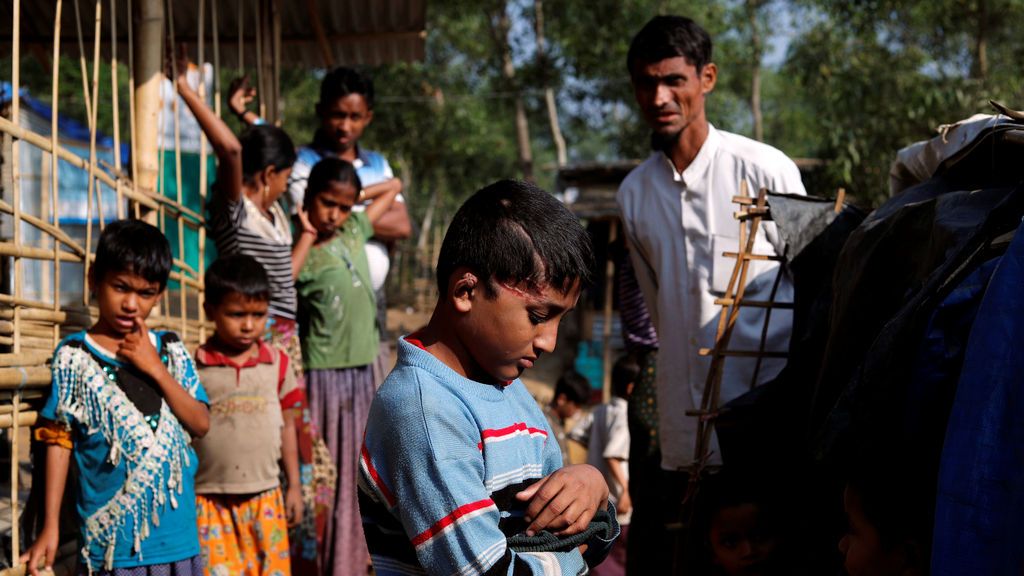 Md Idris, de 10 años, niño refugiado de Rohingya, que dijo haber sido baleado por el ejército de Myanmar hace cuatro meses, posa para una foto en el campo de refugiados de Kutupalong cerca de Cox's Bazar, Bangladesh