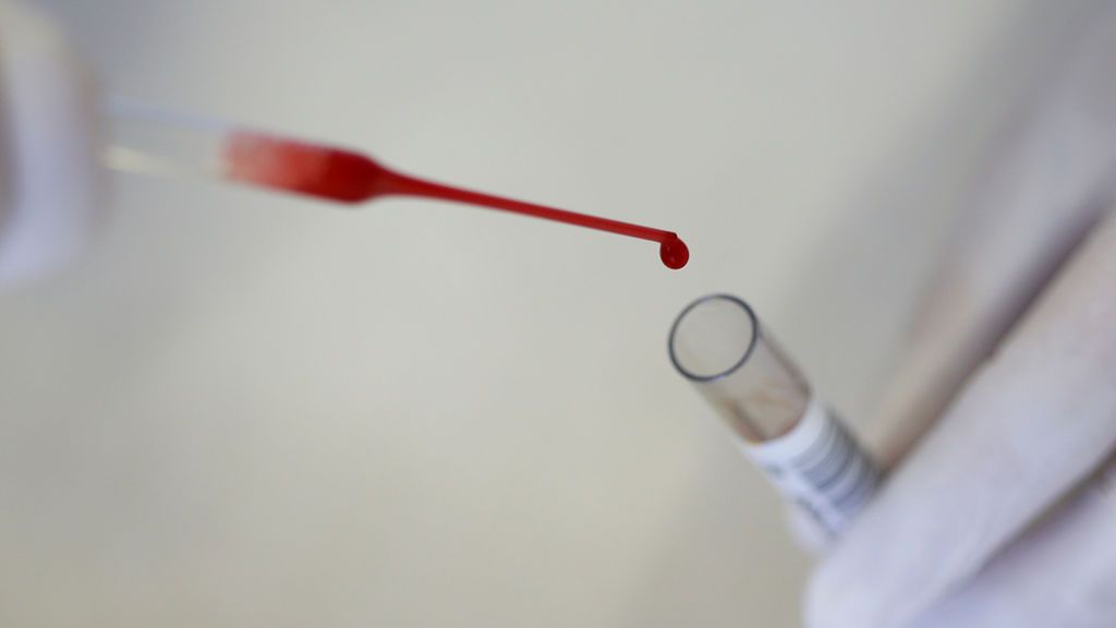 Un test de sangre capaz de detectar hasta 8 tipos de cáncer abre la puerta a la esperanza