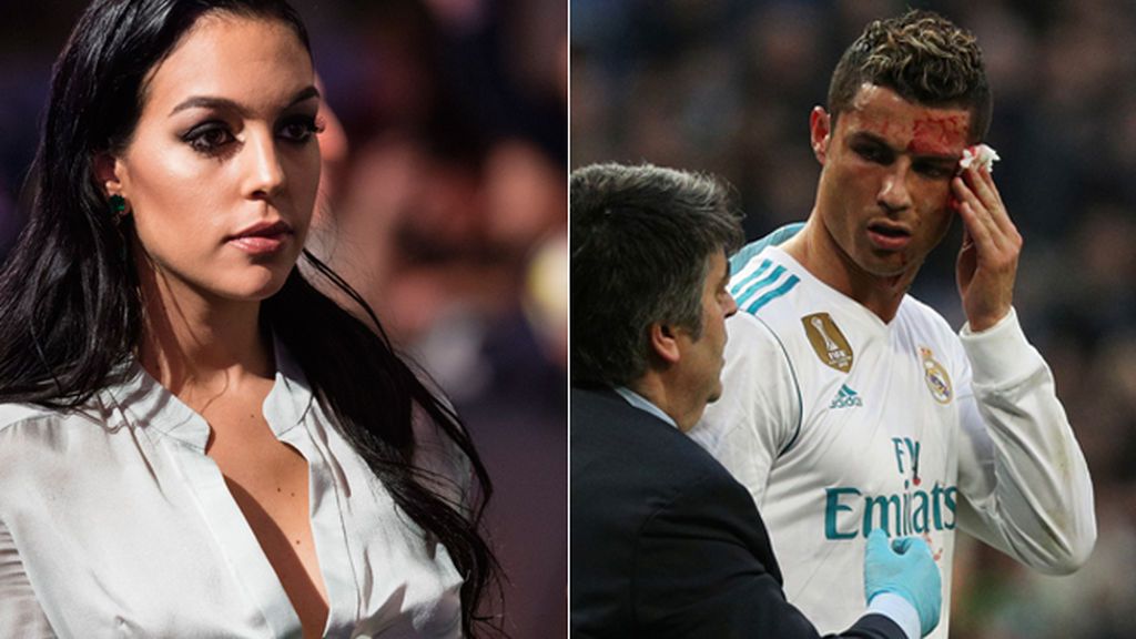 La reacción de Georgina al ver la sangrienta brecha de Cristiano en el Bernabéu