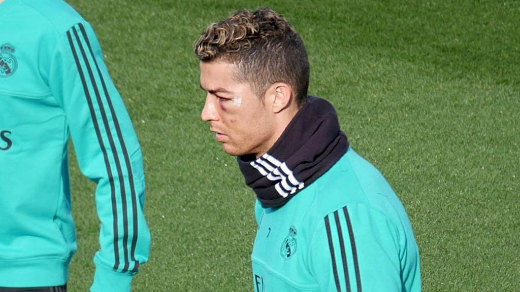 Cristiano Ronaldo reaparece en el entrenamiento del Madrid con el ojo totalmente morado