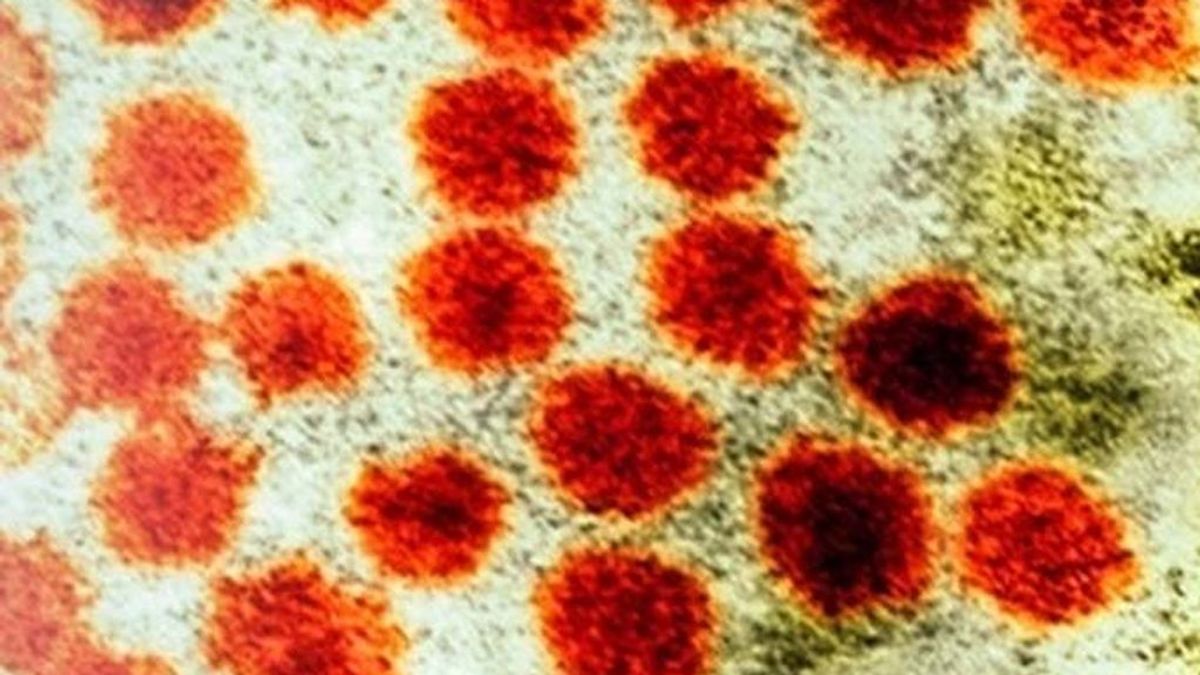 Detectan a 33 afectados por un brote de hepatitis A en un restaurante de Palma