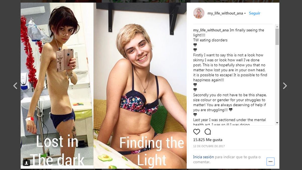 La joven que supera el pronóstico médico y conciencia contra la anorexia en Instagram