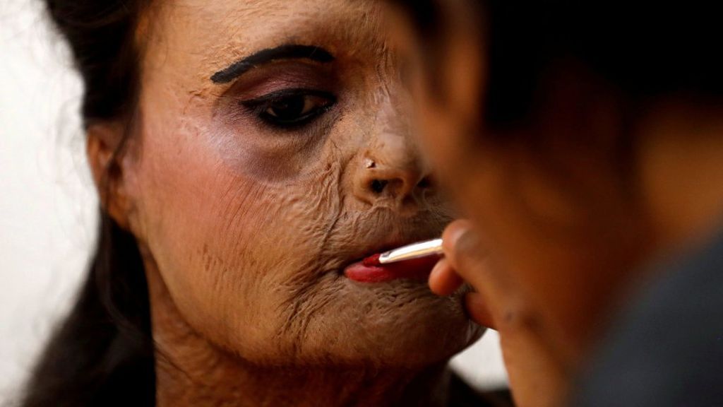 Desfile de modelos desfiguradas en ataques con ácido por el Día Internacional de la Mujer