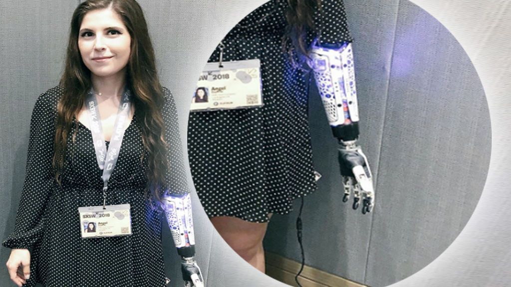 'Cero' en solidaridad: la actriz 'cyborg' a la que nadie cedió un enchufe para cargar su brazo