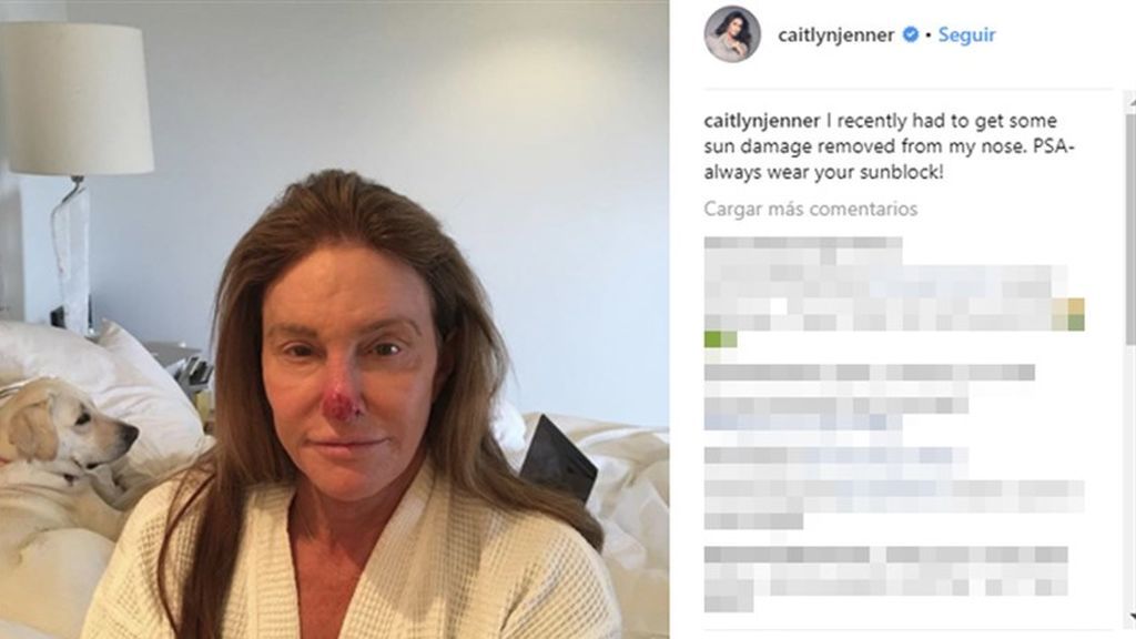 caitlynJenner