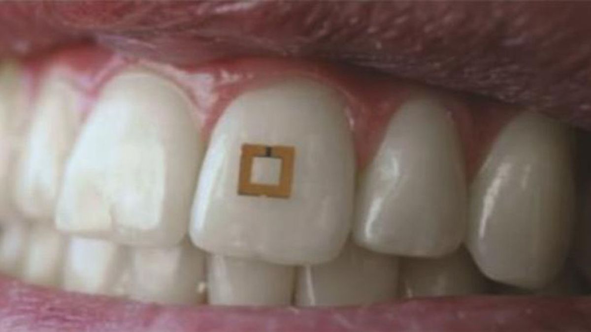 Un pequeño sensor adherido al diente rastrea lo que comes